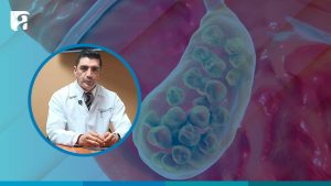 Médico del Hospital de Girón explica síntomas y prevención de los cálculos biliares